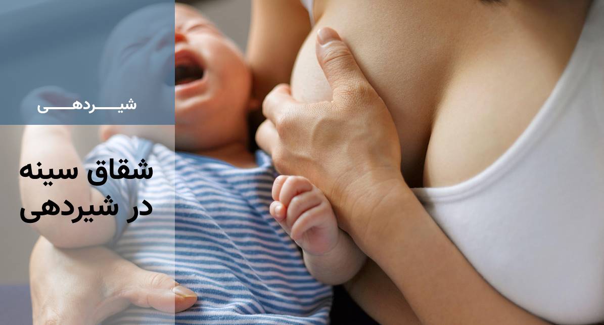شقاق سینه چیست؟